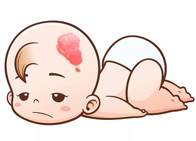 这些行为可能会加重血管瘤，患者一定要避免！